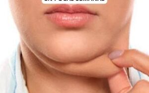 550317701 774152815224906 4424702658502686496 n 300x294