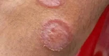 596981185 1360902219415534 7428699450737765881 n 1