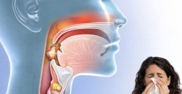 646028940 122196399230505194 6046206595746567204 n