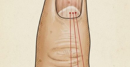 656747609 122171418296877700 1896808350199694210 n