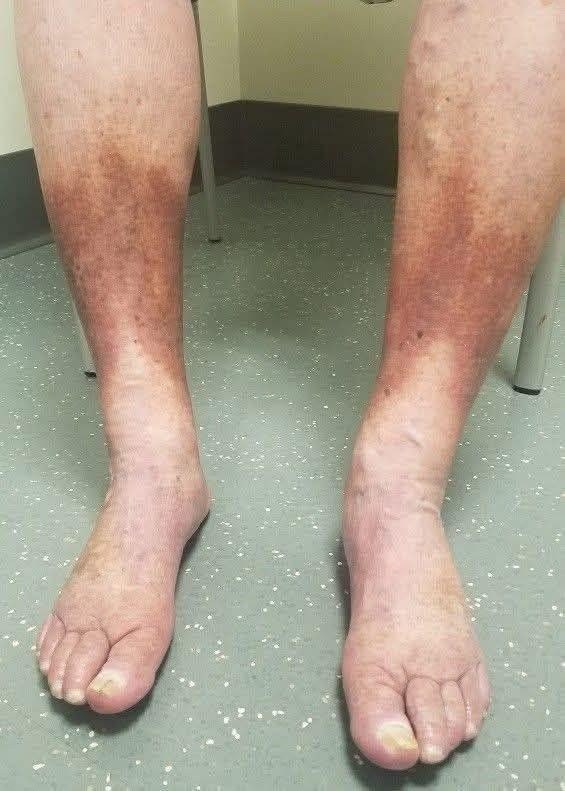 616820297 915675230993211 2871376353541602822 n