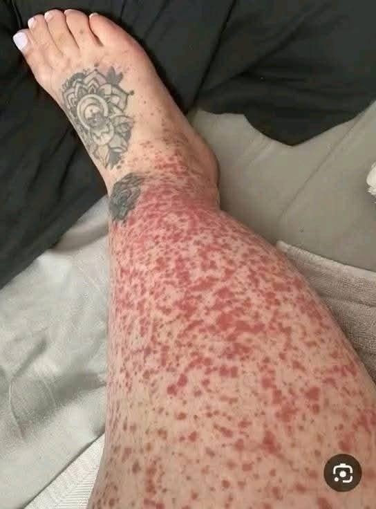 671203407 1017100534006106 7613560880294863136 n