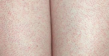 675444738 1520290389666498 7334797330182700427 n