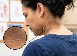 10 Warning Signs of Diabetes You Should Never Ignore 768x560