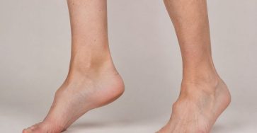 12 Key Signs of Charcot Marie Tooth Disease 768x557